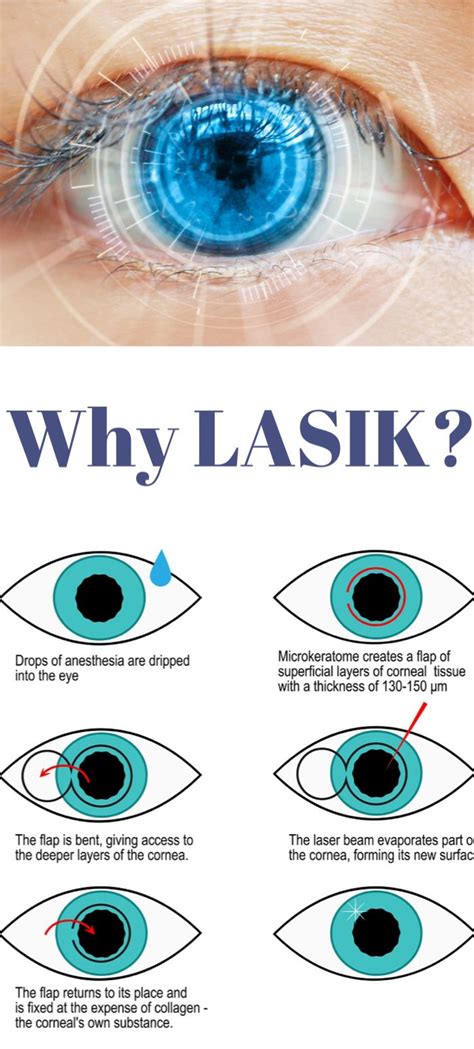 10 Reasons For Eye Surgery Lasik!